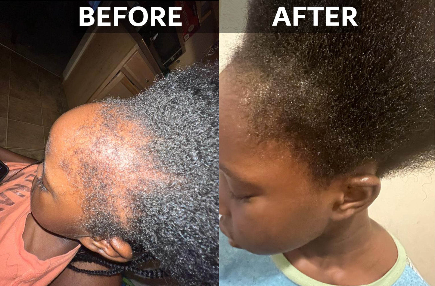 Hair Growth Elixir - GeVi Beauty